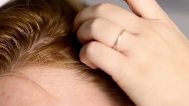 Kafasına serum uygulayan beyaz bir şişeyle sarı saçlı bir kadının fotoğrafını çek. Yüksek kaliteli FullHD görüntüler
