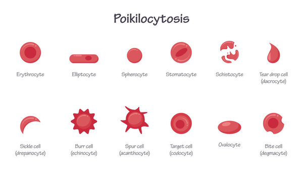 Poikilocytosis morphology of erythrocytes red blood cell RBC educational vector illustration graphic