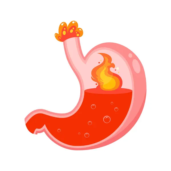 stock vector Stomach acid heartburn vector illustration graphic icon