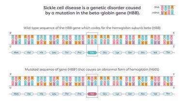 Sickle cell SNP mutation in the beta-globin HBB gene graphic illustration clipart