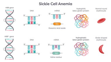 Orak Hücre Anemi HBB nokta mutasyonu grafiği