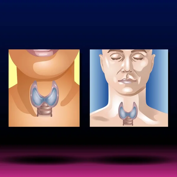 Thyroid Gland - Fla source file available -  Illustration of thyroid gland and phrase Thyroid gland