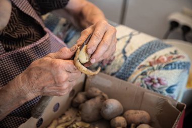 Yaşlı bir kadının elleri patates soyarak ev işi yapıyor. Eklem iltihabı ve kemik iltihabı olan yaşlı eller. İlgili hastalıklara rağmen aktif yaşlanma kavramı. Kapat.