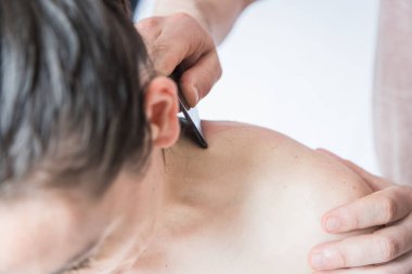 Beyaz Kadın Vücut Tedavisine Gidiyor. Deri kazıma tekniği üzerinde çalışan bir terapist. Çin tekniği, gua sha, ağrı kesici ve tedavi için ve kan dolaşımını aktive etmek için. Uyarıcı terapi.