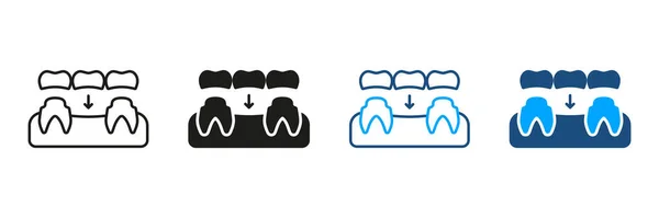 歯科ブリッジシルエットとラインアイコンセット 磁器の入れ歯 歯の再生ピクトグラム 歯の一部が修復されます 歯科治療シンボルコレクション 絶縁ベクトルイラスト — ストックベクタ