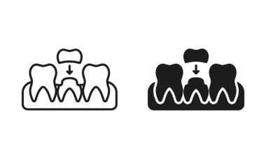 Diş Tacı, Ortodontik Diş Silueti ve Satır Simgesi. Diş Tacı, İmplant. Diş Sağlığı Koruma Programı. Diş tedavisi işareti var. Oral Bakım Siyah Sembol Koleksiyonu. İzole Vektör İllüstrasyonu.