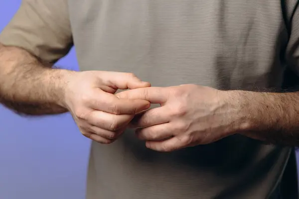 Adam kronik artritten muzdarip. Parmaklarının eklemlerinde ağrı var. Eklemlerdeki iltihaplanma, osteoartrit kıkırdak ya da romatizma eklem iltihabından kaynaklanabilir. Eller yakın plan.