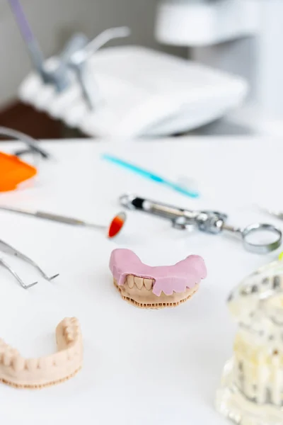 Studio Dentistico Calco Denti Denti Falsi Impianti Strumenti Dentali Sul — Foto Stock