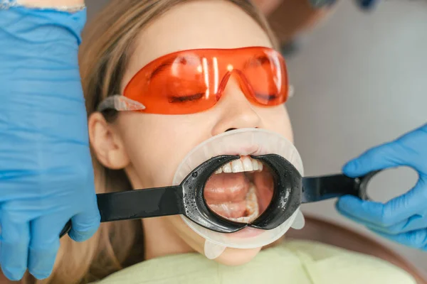 金髪の美しい女性は 口を開いた歯の椅子に座って赤いメガネを着ています 歯科医 歯科検査 歯科手順を訪問する女性患者 デンタルケアコンセプト — ストック写真