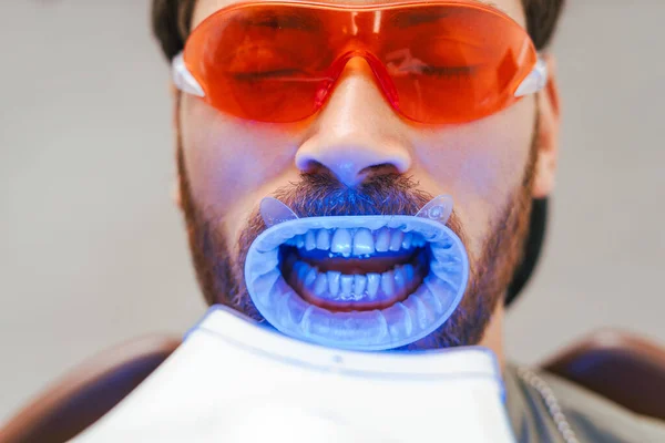 Yakışıklı Sakallı Adam Modern Diş Kliniğinde Dişleri Beyazlatan Hasta Diş — Stok fotoğraf