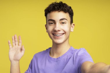 Heyecanlı genç bir çocuğun portresi, diş teli sallayan, sıradan mor bir tişört giyen, sarı arka planda izole edilmiş kameraya bakan. Günlük konsepti