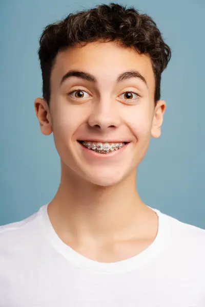 Närbild Porträtt Förvånad Pojke Med Tandställning Tänder Tittar Kameran Isolerad — Stockfoto