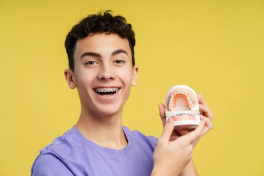 Gülümseyen, kıvırcık saçlı diş telleri olan, elinde diş kalıpları olan, gülen, sarı arka planda soyutlanmış bir gencin yakın çekimi. Ortodontik terapi kavramını vurgular 