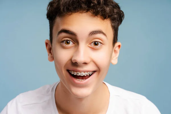 Fantastisk Pojke Med Tandställning Tänder Tittar Kameran Isolerad Blå Bakgrund — Stockfoto