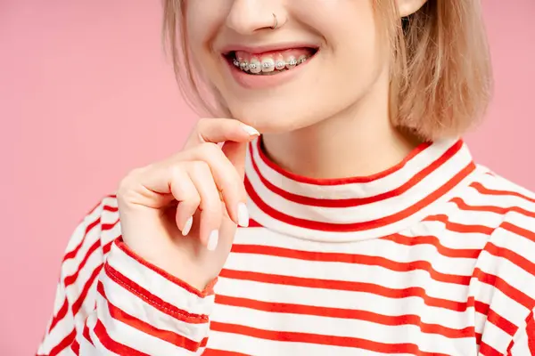 美丽而快乐的年轻女子 金发碧眼 带着大括号 面带微笑 快乐的女生被粉色背景隔离了 牙科护理的概念 — 图库照片