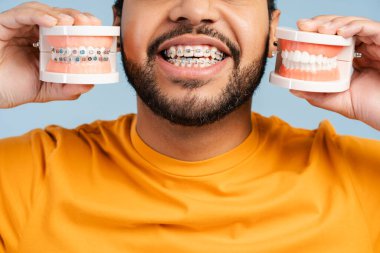Afro-Amerikalı mutlu bir adamın yakın plan fotoğrafı ortodontik diş telleriyle gülümsemesini gösteriyor, mavi arka planda izole edilmiş plastik çene modelleri tutuyor. Diş sağlığı konsepti