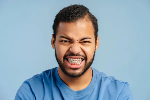 Portrait Photo Expressive African American Man Braces Grimacing Rage Looking — Stock Photo, Image