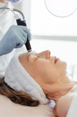 Kozmetik Güzellik Kliniği 'nde yaşlı, yaşlı bir kadının yüz hidro mikro dermabrüksiyon tedavisi gördüğü yakın plan. Yenilenme, kozmetoloji kavramı