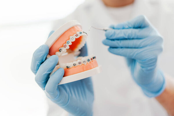 Dentist's work in dental office, showing jaw with braces. Orthodontic treatment, dental care concept