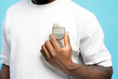 Göğse yerleştirilen kalp pili cihazını ortaya çıkaran bir hastanın yakından görüntüsü gelişmiş tıbbi teknolojiyi ve kalp bakımındaki rolünü vurguluyor. Sağlık hizmeti kavramı