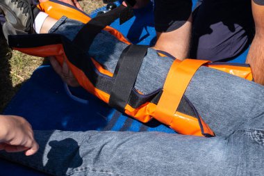 Bir kaza durumunda, kurtarma ekipleri tarafından bandajda muhtemel bir kırık oluşmuş.