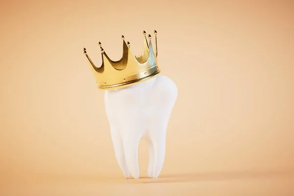 Conceito Tratamento Dentário Grande Molar Uma Coroa Fundo Pastel Renderização — Fotografia de Stock