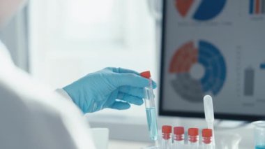 Sağlık göstergelerini belirlemek, hastalıkları teşhis etmek ve tedavinin etkinliğini izlemek için kan ve diğer biyolojik sıvıların tıbbi analizi. Bir tıp laboratuarında araştırmacıyım. Yüksek kalite 4k