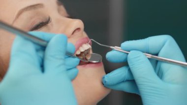 Klinikteki profesyonel teşhisler ve diş hekimi tarafından sorunların tanımlanması. Hasta, profesyonel diş bakımının gülümsemeyi sürdürmeye yardımcı olduğunu biliyor. Gözden geçirme işlemi. Yüksek kalite 4k