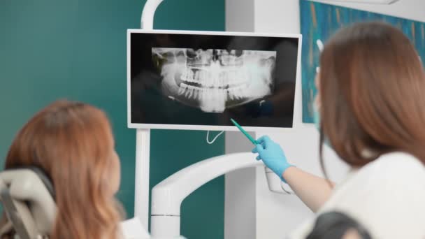 歯科医は 詳細な検査のために彼女の歯の女性X線を示しています 歯科医は口腔内の問題を正確に診断するためにパノラマのトモグラフィーを使用します 高品質の4K映像 — ストック動画