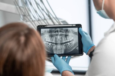 Diş hekimi bir tablette hastaların dişlerinin panoramik tomografisinin sonuçlarını gösteriyor. Hasta, ağız boşluğu için röntgen kullanılarak muayene, konsültasyon ve tedavi görüyor. Yüksek