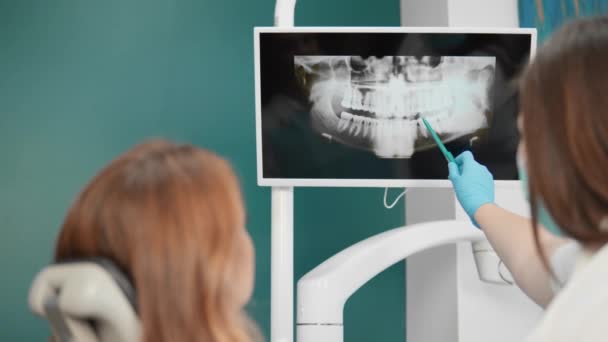 Odontólogo Informa Profesionalmente Paciente Sobre Radiografía Ilustrando Los Cambios Patológicos — Vídeo de stock