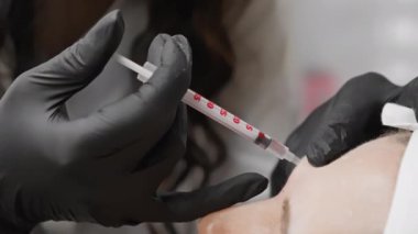 Bu video, hastanın alnına iğne yapan siyah eldivenli bir tıp uzmanının yakın plan görüntüsünü içeriyor. Tıbbi, kozmetik ve sağlık konuları için mükemmel..