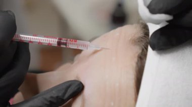 Alnına eldiven takan bir profesyonelin enjekte ettiği kozmetik bir işlemden geçen birinin yakın çekimi. Tedavi, kırışıklıkları ve ince çizgileri azaltmaya odaklanıyor..