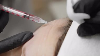 Bu resim, bu kozmetik tedavinin hassasiyetini ve önemini vurgulayarak kırışıklık gidermek için botulinyum enjeksiyonlarını ustalıkla yöneten bir profesyonelin yakın çekimini gösteriyor.