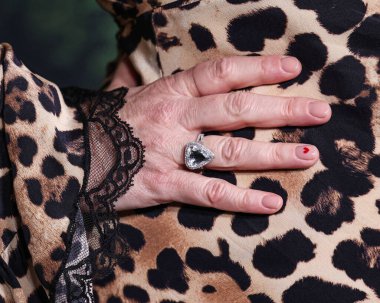 Melanie Lynskey, Paramount + With Showtime 'ın 