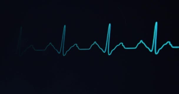 病院で心拍数モニターのクローズアップ4K映像 60Fpsビデオ — ストック動画