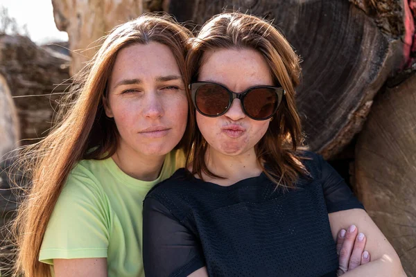 两个非常友善的女人自私自利地做着滑稽的脸 — 图库照片
