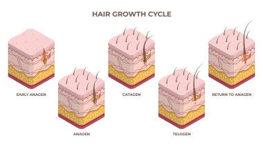 Isometric saç büyütme döngüsü, anagen, telojen, katagen aşamaları. Kıl folikül büyümesi düz vektör illüstrasyonlu insan derisi katmanları. Saç büyütme aşamaları