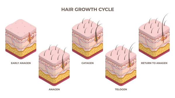 等距头发生长周期 胶原蛋白阶段 人类皮肤层与毛囊生长扁平的载体图集 毛发生长阶段 — 图库照片