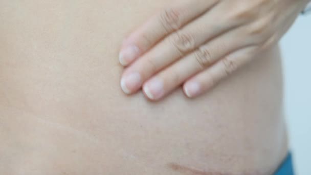 Utilisation Crème Pour Soigner Les Cicatrices Après Chirurgie Appendice — Video