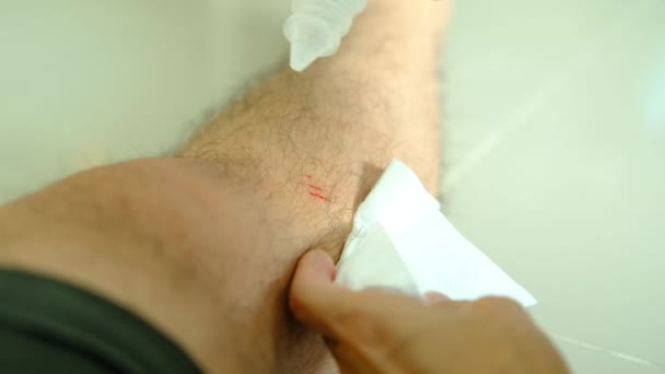 女性の手は出血した足の傷を洗うために液体を使用します — ストック動画