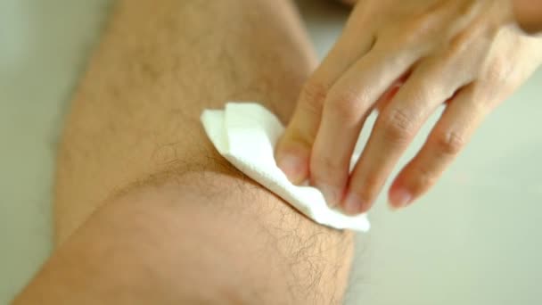 Mano Una Mujer Usa Líquido Para Lavar Una Herida Sangrante — Vídeos de Stock