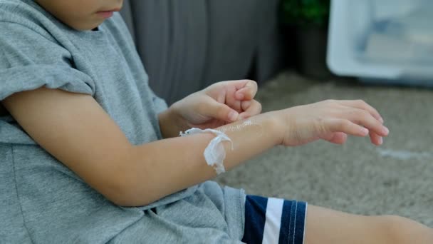 Руки Маленького Азиатского Мальчика Сдирают Сухую Кожу Руки Проблемы Кожи — стоковое видео