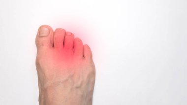 A Right foot toes of a person with a red mark representing pain clipart