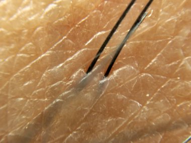 İnsan derisinin detaylı bir yakın çekimi, doku ve desenleri görünür saç folikülleriyle birlikte ortaya çıkarıyor. Doğal ışık, küçük kusurları ve cilt yüzeyinin organik doğasını vurgulayarak özelliklerini artırır..