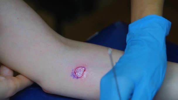 Tattoo Kunstenaar Maakt Hand Porren Tatoeage Kleine Aardbeientattoo — Stockvideo