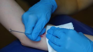 Dövmeci, el dürtme dövmesi yapar. Küçük çilek dövmesi..