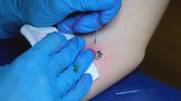 Художник Татуювання Робить Татуювання Рукою Маленьке Полуничне Татуювання — стокове відео