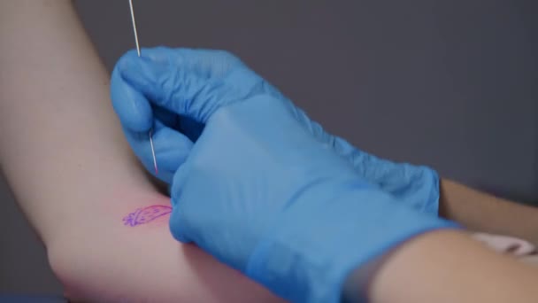 Процес Набивання Татуювання Крупним Планом Рука Витискає Татуювання Крупним Планом — стокове відео