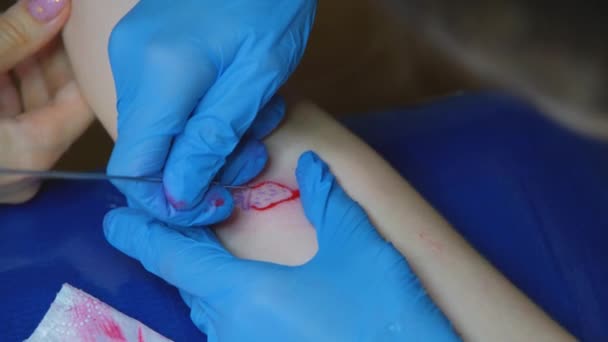 Tatuagem Artista Faz Mão Cutucar Tatuagem Tatuagem Morango Pequeno — Vídeo de Stock